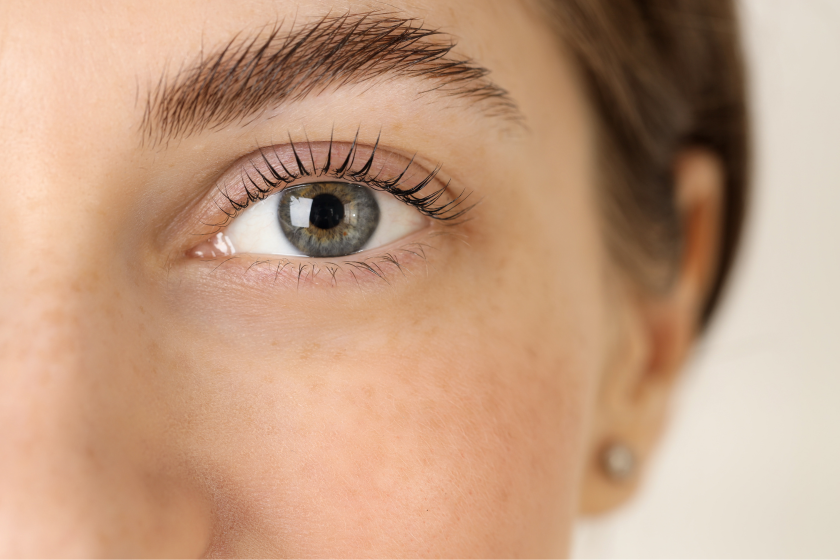 Ultherapy brow lift at H-MD Medical Spa